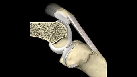 Knee Flexion & Patellar Motion Animation, ©Primal Pictures Ltd