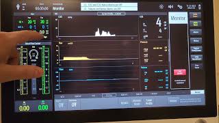 Mindray A8 Monitor Mode
