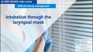 Difficult airway management: Intubation through the Laryngeal mask