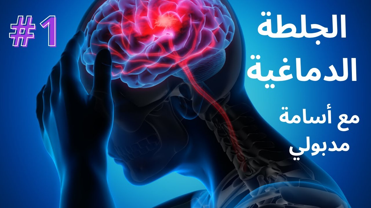 ارشادات للجلطة الدماغية Stroke Instructions الجزء 1 | مع اسامة مدبولي