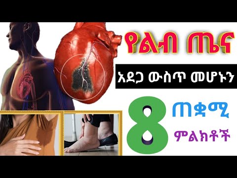 ቪዲዮ: በሞቃት ሰውነት ውስጥ ጁሊ ስንት ዓመቷ ነው?