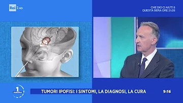 Quanto dura l'intervento di rimuovere ipofisi?