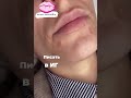 Мужские губы увеличение #мужскиепрактики #мужскойманикюр #мужскойуход #мужскойклуб #мужскаямода