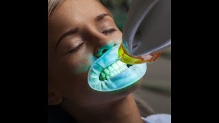 Iveri Teeth Whitening Solution fast