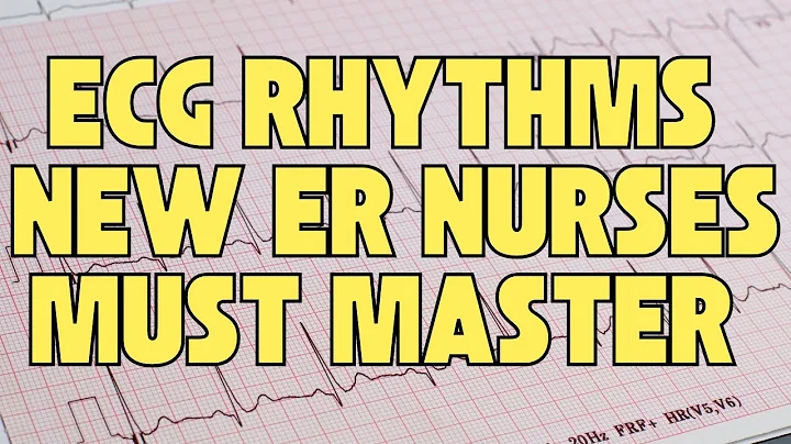 ECG's New ER Nurses Must Master!  Rhythms you should know by the end of your training  l  ER nursing