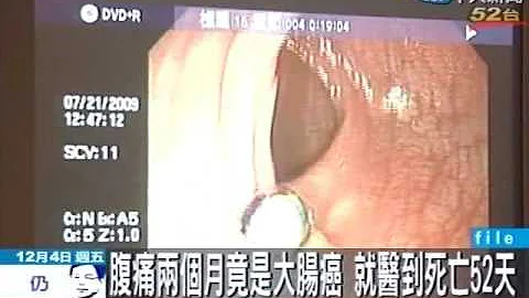 腹痛2個月竟是大腸癌 就醫到死亡52天 - 天天要聞