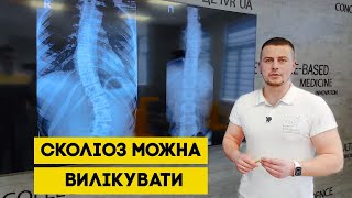 Як правильно лікувати сколіоз