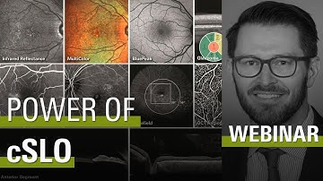 Harnessing the Power of cSLO with SPECTRALIS