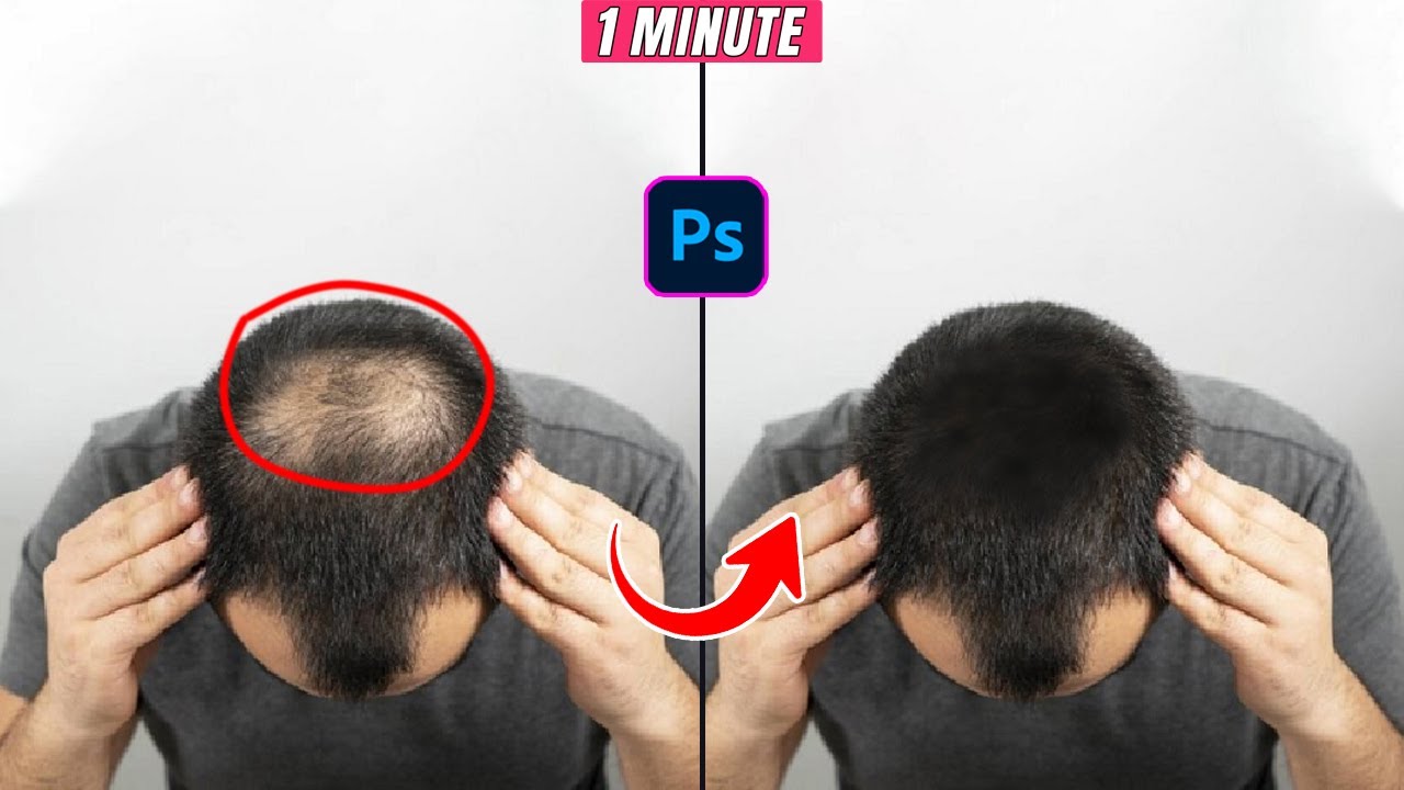 How to remove hair fall gap in 2024 Fill Hair & Eyebrows in