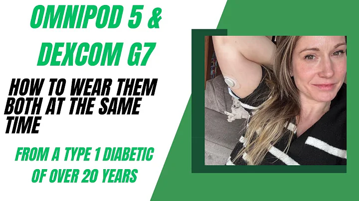 TYPE 1 DIABETIC TALKS OMNIPOD 5 & DEXCOM PLACEMENT  #type1diabetes #diabetes