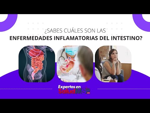 ¿Cuáles son las