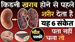कडन खरब हन स पहल दत ह यह 6 सकत, पत नह चल त नकसन ह सकत ह