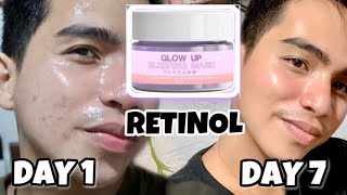 RETINOL FOR 7 DAYS? WATCH THIS BEFORE BUYING TRENDING GLOW UP SLEEPING MASK ( 7 DAYS COMPILATION )
