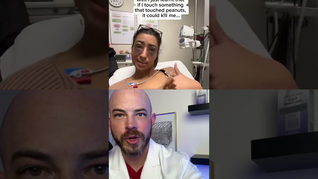 Derm Reacts To Peanut Allergy Doctorreacts Dermreacts