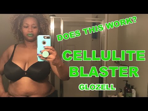 Does This Work? Cellulite Blaster - GloZell