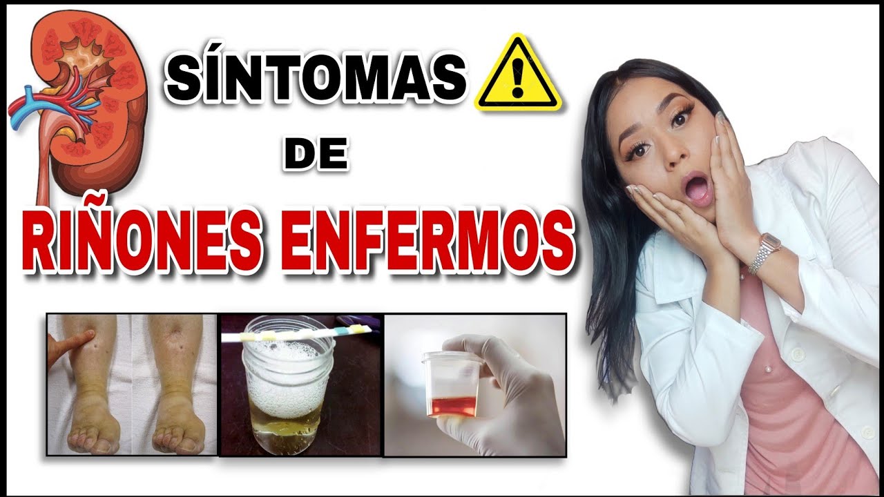 SEÑALES que Indican que tus RIÑONES están ENFERMOS😨 | Signos y Síntomas ...