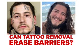 NKY jail partners with nonprofit to offer inmates free tattoo removal