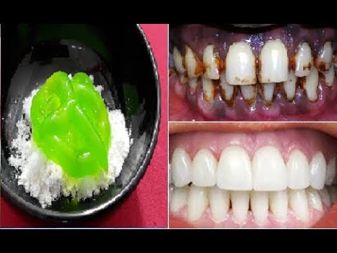 RĂNG ĐEN XÌ ĐEN XỊT CŨNG TRẮNG BÓC NHƯ BỌC SỨ VỚI NGUYÊN LIỆU TỪ BỘT GẠO NẾP GẠO TẺ RĂNG ĐEN XÌ ĐEN XỊT CŨNG TRẮNG BÓC NHƯ BỌC SỨ VỚI NGUYÊN LIỆU TỪ BỘT GẠO NẾP GẠO TẺ #1