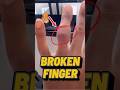 Bianca Belair Shows Off Broken Finger Without Splint! #wwe #wrestling #biancabelair #shorts
