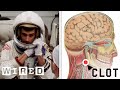 Nasa flight surgeon explains how to treat a blood clot in space  wired