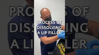 Can Lip Fillers Be Dissolved Dr Lulic Explains It All Here shorts medspa lipfiller fillers