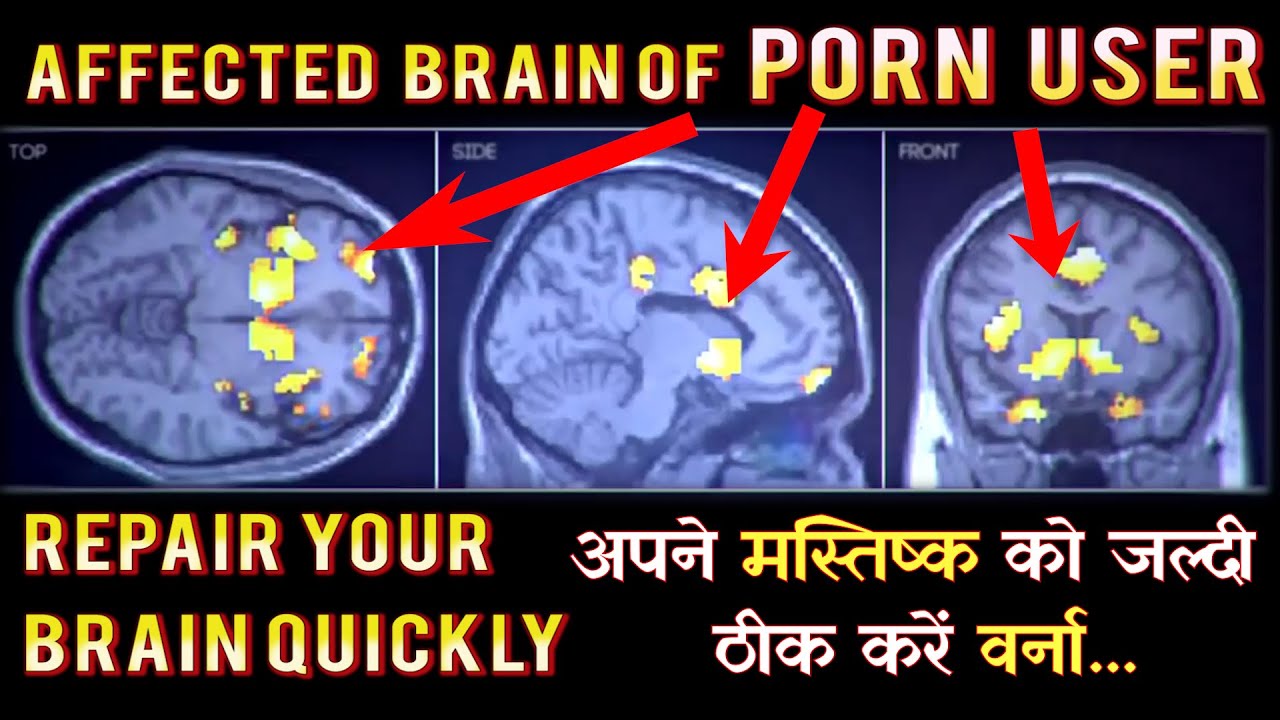 Nobody Tells You to Repair Affected Brain After Porn Addicted           