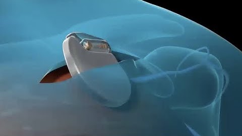 Pacemaker