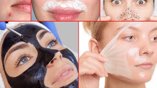 Remove Acne, Blackheads, and Facial Hair Instantly with This Skin Whitening Peel Off Mask