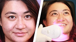 Women Find The Cause Of Their Acne