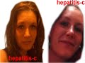   Natalie Beatham Torrington CT Hepatitis-C Alert