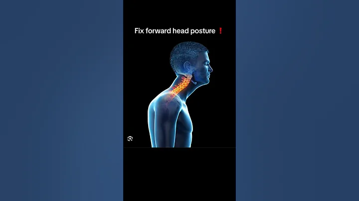 How to fix forward head posture (nerd neck) - DayDayNews