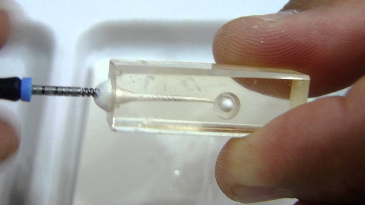 FÁCIL COLOCACIÓN DEL HIDRÓXIDO DE CALCIO EN TRATAMIENTOS DE ENDODONCIA