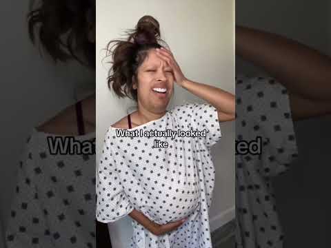 Video: Nainen synnyttää GP-leikkauksen jälkeen vatsakipu