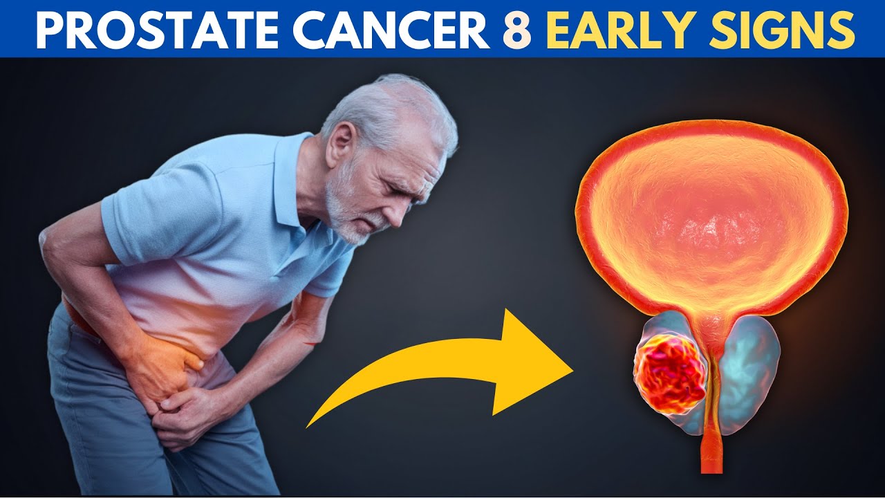 Don’t Miss These 8 Early PROSTATE CANCER Signs – They Could Save Your ...