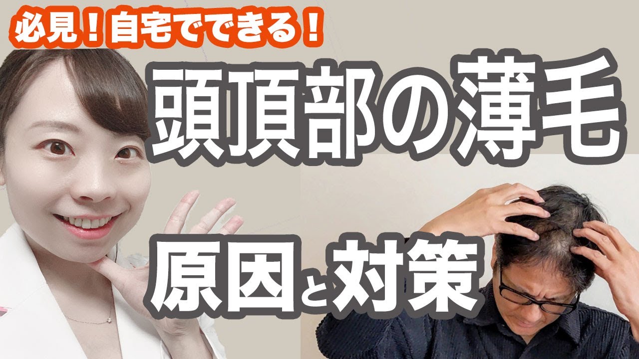 【医師解説】頭頂部の薄毛＆抜け毛 原因はこれだ！_ 改善法を徹底解説【てっぺんはげ】