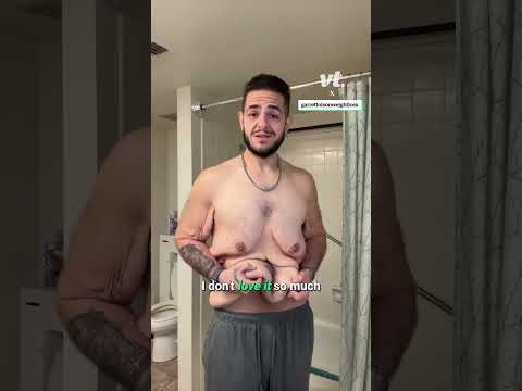 تحول مذهل في خسارة الوزن