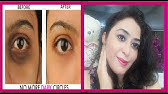 5 minute Face Yoga exercise to Get rid of Under Eye Dark Circles, Wrinkles & Puffy Eyes - YouTube