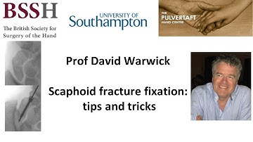 Tips and tricks on fixing scaphoids by Prof David Warwick