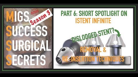 MSSS-3 iStent Infinite: MIGS Success Surgical Secrets Spotlight on iStent Infinite Re-insertions