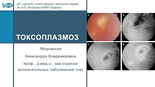 Токсоплазмоз и токсоплазмозное поражение глаза