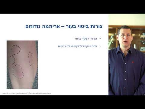 תסמינים עוריים - דר&rsquo; אמיר ויצברד