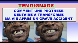 Témoignage Comment Une Prothèse Dentaire A Transformé Ma Vie Après Un Grave Accident