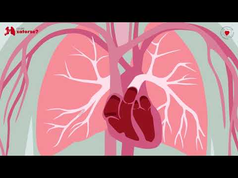 Video: Pľúcny Granulóm