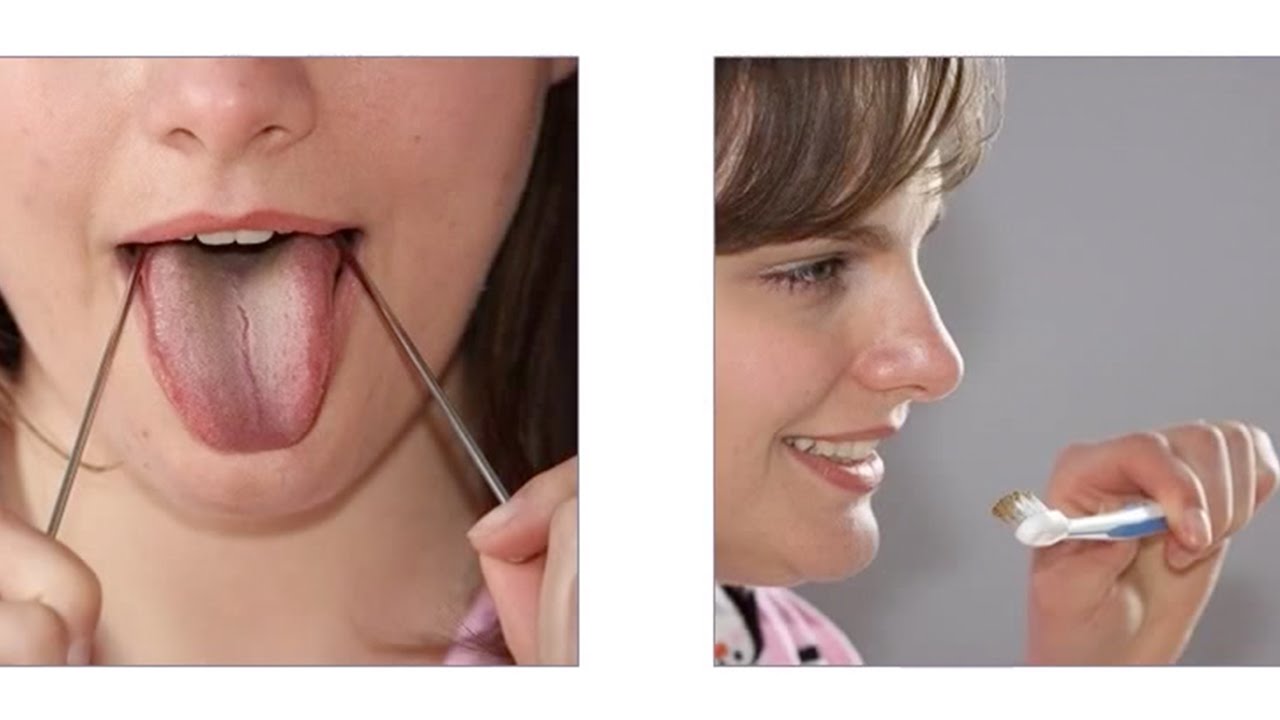 How to clean your tongue deals