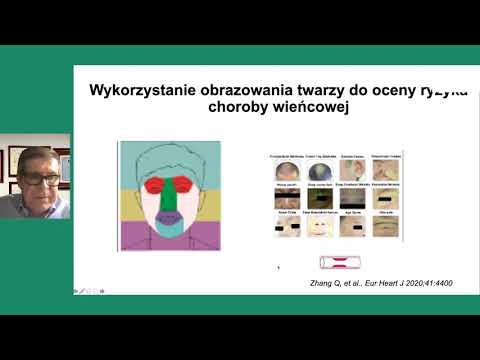 Choroba wieńcowa i zawał mięśnia serca – najnowsze doniesienia