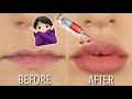 HOW TO GET FULLER LIPS AT HOME | NO FILLER | DIY | Hannah Dorman