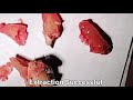 maxillary 6 number molar extraction#dentition#upar ki daad kaise nikale