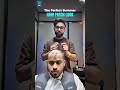 Summer Hair Patch look #hairloss #wigsinstall #wig #patch #hairreplacement #kolkata #siliguri