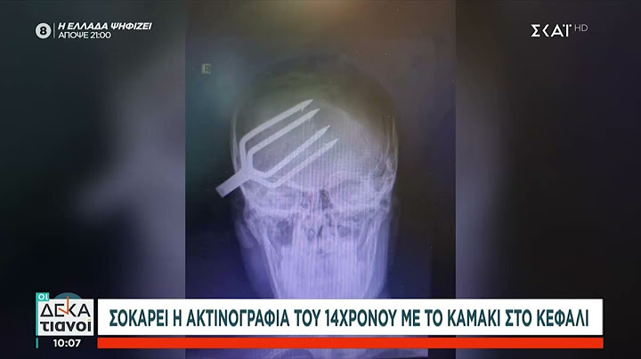 Σοκάρει η ακτινογραφία του 14χρονου με το καμάκι στο κεφάλι | Οι Δεκατιανοί | 21/06/2025