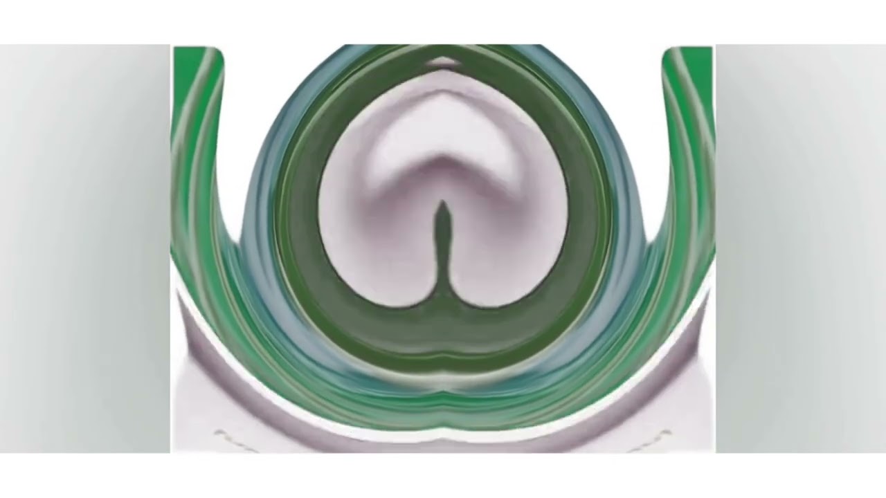 The Gummy Bear Song in IZFTOT’s Super Duper High Pitched G Major 4 CoNfUsIoN